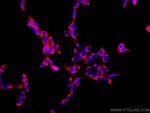 PABPC1,PABP Antibody in Immunocytochemistry (ICC/IF)