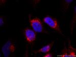 Syntaxin 10 Antibody in Immunocytochemistry (ICC/IF)