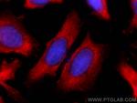 VEGFA Antibody in Immunocytochemistry (ICC/IF)