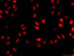ASF1A Antibody in Immunocytochemistry (ICC/IF)