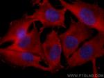 DLC1 Antibody in Immunocytochemistry (ICC/IF)