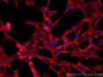 BLNK Antibody in Immunocytochemistry (ICC/IF)