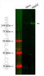 Hexokinase 2 Antibody in Western Blot (WB)