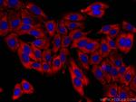 CAPN2 Antibody in Immunocytochemistry (ICC/IF)