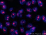 FBL Antibody in Immunocytochemistry (ICC/IF)
