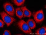 GNAI2 Antibody in Immunocytochemistry (ICC/IF)