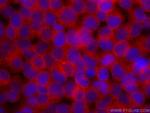 ADRBK1 Antibody in Immunocytochemistry (ICC/IF)