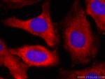 Calpastatin Antibody in Immunocytochemistry (ICC/IF)