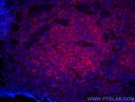 RIAM, APBB1IP Antibody in Immunohistochemistry (PFA fixed) (IHC (PFA))