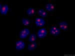 GNL3 Antibody in Immunocytochemistry (ICC/IF)