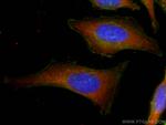 Cytohesin 2 Antibody in Immunocytochemistry (ICC/IF)