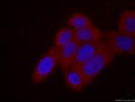 KIF20A Antibody in Immunocytochemistry (ICC/IF)
