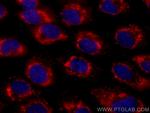 GNMT Antibody in Immunocytochemistry (ICC/IF)