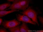 MAP2K4 Antibody in Immunocytochemistry (ICC/IF)