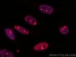 TH1L Antibody in Immunocytochemistry (ICC/IF)