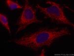 Caspase 4 Antibody in Immunocytochemistry (ICC/IF)