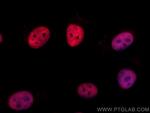 PTBP1 Antibody in Immunocytochemistry (ICC/IF)