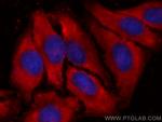 PGAM1 Antibody in Immunocytochemistry (ICC/IF)