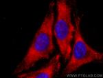 TPI1 Antibody in Immunocytochemistry (ICC/IF)