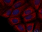 CCT8 Antibody in Immunocytochemistry (ICC/IF)