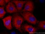 GSTM3 Antibody in Immunocytochemistry (ICC/IF)