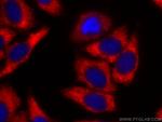 TAK1 Antibody in Immunocytochemistry (ICC/IF)
