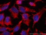Alix Antibody in Immunocytochemistry (ICC/IF)