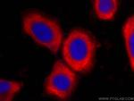 RPL6 Antibody in Immunocytochemistry (ICC/IF)