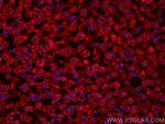 ACADM Antibody in Immunohistochemistry (PFA fixed) (IHC (PFA))