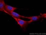 RAB1B Antibody in Immunocytochemistry (ICC/IF)