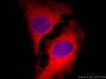 CIP2A Antibody in Immunocytochemistry (ICC/IF)