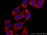 ADC Antibody in Immunocytochemistry (ICC/IF)