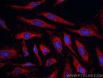 KBTBD2 Antibody in Immunocytochemistry (ICC/IF)