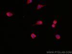 FARSB Antibody in Immunocytochemistry (ICC/IF)