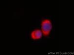 FARSB Antibody in Immunocytochemistry (ICC/IF)