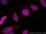 TNIK Antibody in Immunocytochemistry (ICC/IF)