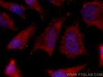 DDX1 Antibody in Immunocytochemistry (ICC/IF)