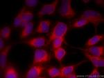 ALDH3A1 Antibody in Immunocytochemistry (ICC/IF)