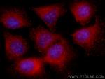 NCAPG Antibody in Immunocytochemistry (ICC/IF)
