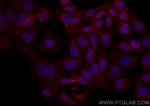 NSFL1C Antibody in Immunocytochemistry (ICC/IF)