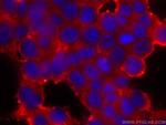 CCT2 Antibody in Immunocytochemistry (ICC/IF)
