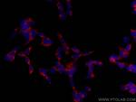 UNC13A Antibody in Immunocytochemistry (ICC/IF)