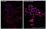 Phospho-P53 (Ser15) Antibody in Immunocytochemistry (ICC/IF)