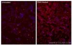 Phospho-mTOR (Ser2448) Antibody in Immunocytochemistry (ICC/IF)