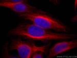 Alpha Tubulin Antibody in Immunocytochemistry (ICC/IF)