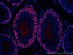 PCNA Antibody in Immunohistochemistry (Paraffin) (IHC (P))