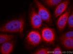 Calnexin Antibody in Immunocytochemistry (ICC/IF)