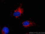 SOD2 Antibody in Immunocytochemistry (ICC/IF)