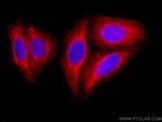 Cytokeratin 14 Antibody in Immunocytochemistry (ICC/IF)