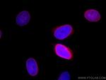 Emerin Antibody in Immunocytochemistry (ICC/IF)